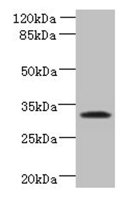 Western blot. All lanes: TSPAN5 antibody at 1.2µg/ml + Jurkat whole cell lysate. Secondary. Goat polyclonal to rabbit IgG at 1/10000 dilution. Predicted band size: 31 kDa. Observed band size: 31 kDa