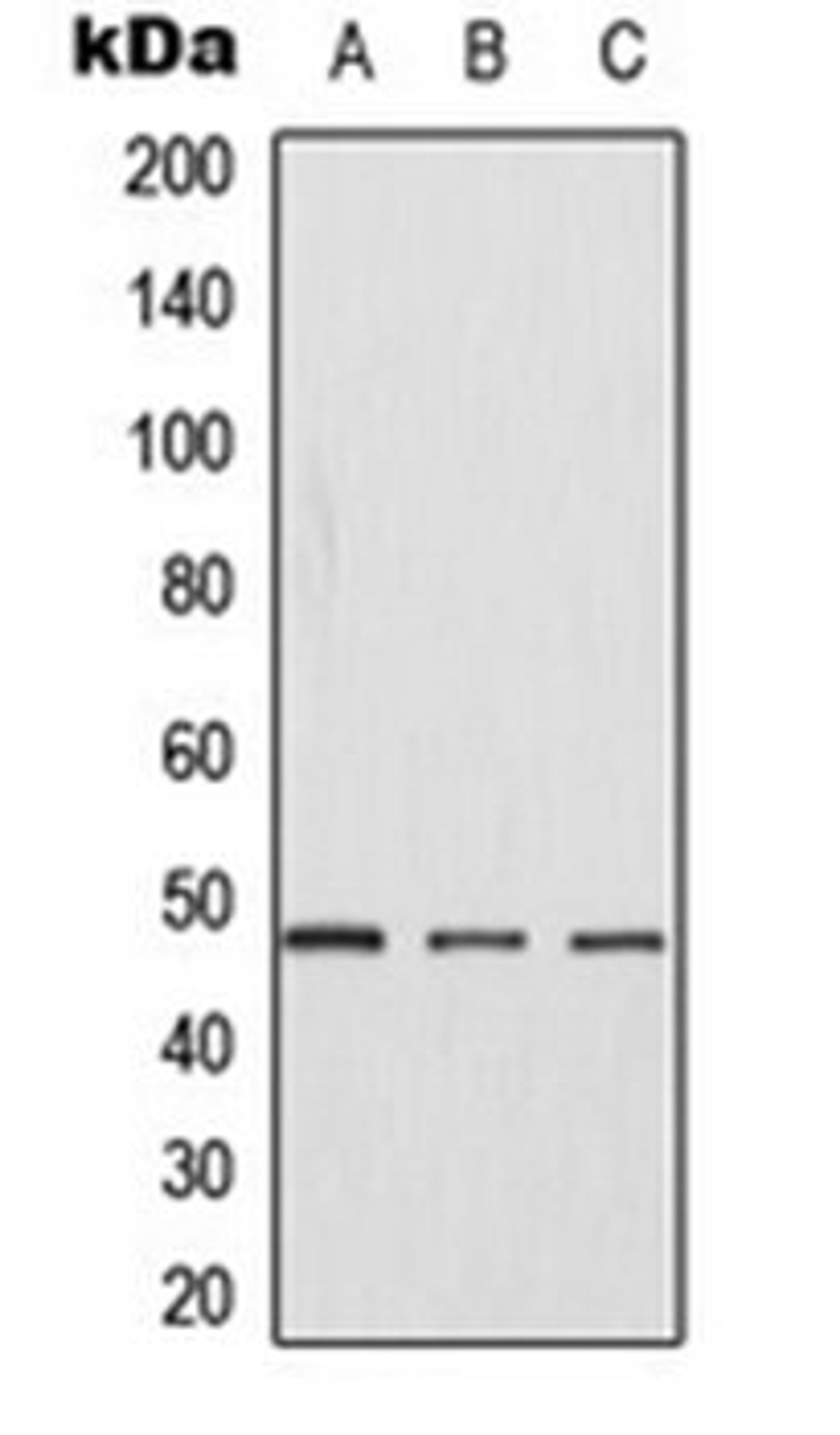 Western blot analysis of Jurkat (Lane 1), NIH3T3 (Lane 2), H9C2 (Lane 3) whole cell lysates using CK1 gamma 1 antibody