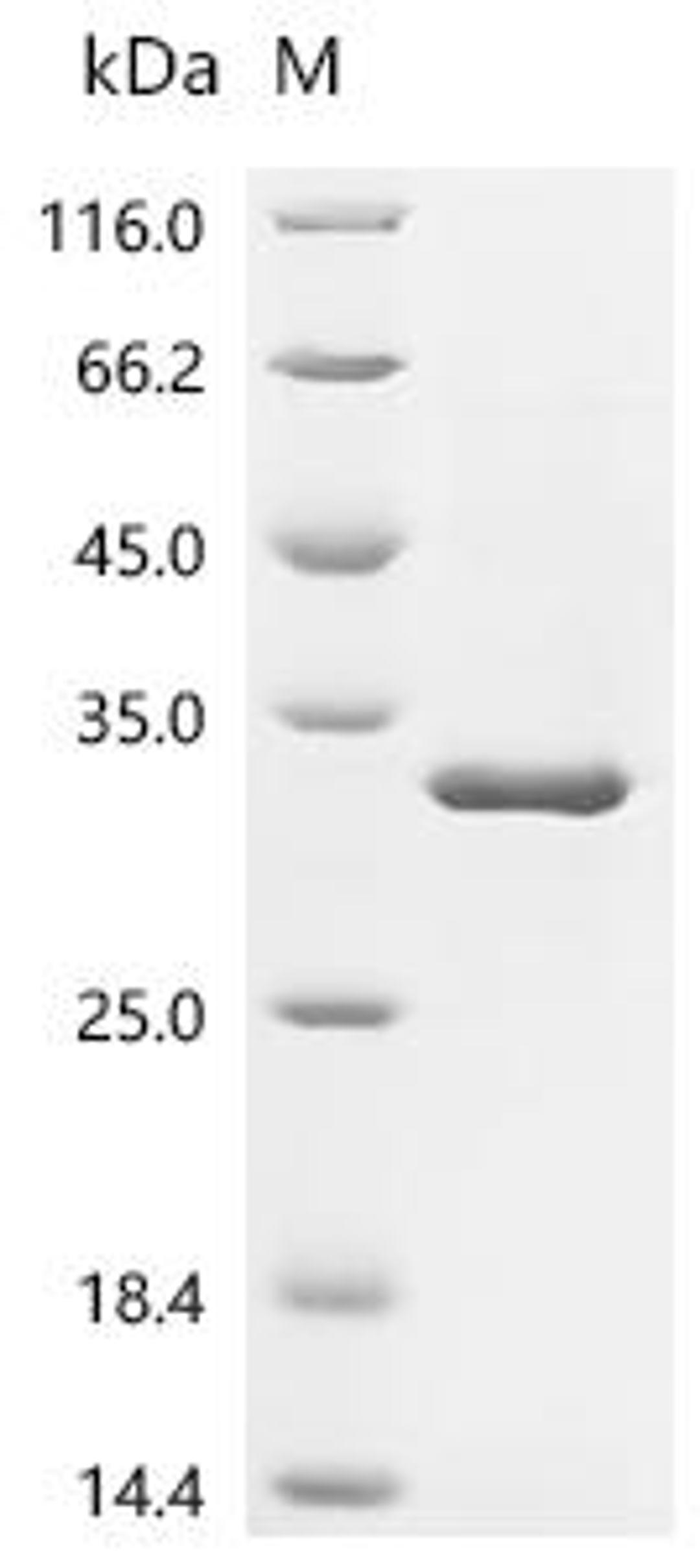 (Tris-Glycine gel) Discontinuous SDS-PAGE (reduced) with 5% enrichment gel and 15% separation gel.