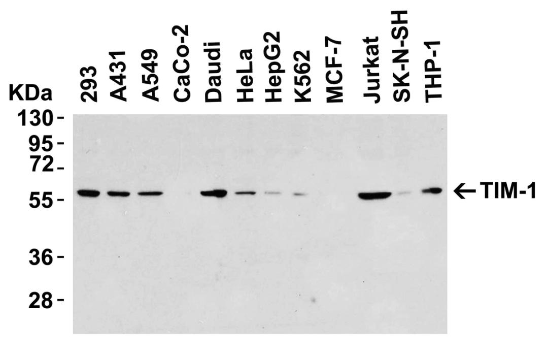 <strong>Figure 1 Western Blot Validation in Human Cell Lines</strong><br>
Loading: 15 &#956;g of lysates per lane.
Antibodies: TIM-1 3809 (8 &#956;g/mL), overnight incubation at 4&#730; C in 5% NFDM/TBST.
Secondary: Goat anti-rabbit IgG HRP conjugate at 1