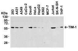 <strong>Figure 1 Western Blot Validation in Human Cell Lines</strong><br>
Loading: 15 &#956;g of lysates per lane.
Antibodies: TIM-1 3809 (8 &#956;g/mL), overnight incubation at 4&#730; C in 5% NFDM/TBST.
Secondary: Goat anti-rabbit IgG HRP conjugate at 1