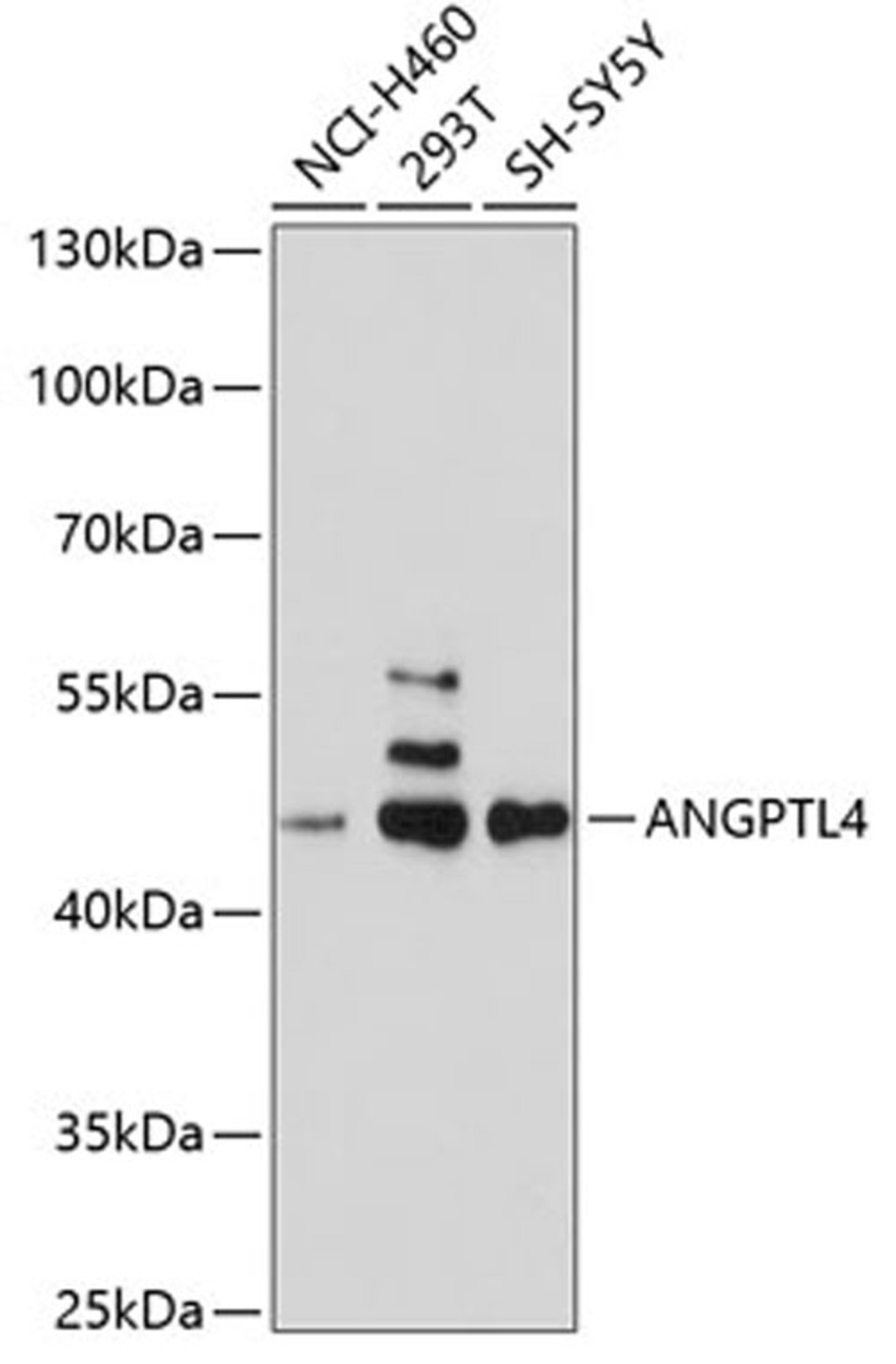 Western blot - ANGPTL4 antibody (A2011)