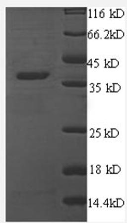 (Tris-Glycine gel) Discontinuous SDS-PAGE (reduced) with 5% enrichment gel and 15% separation gel.