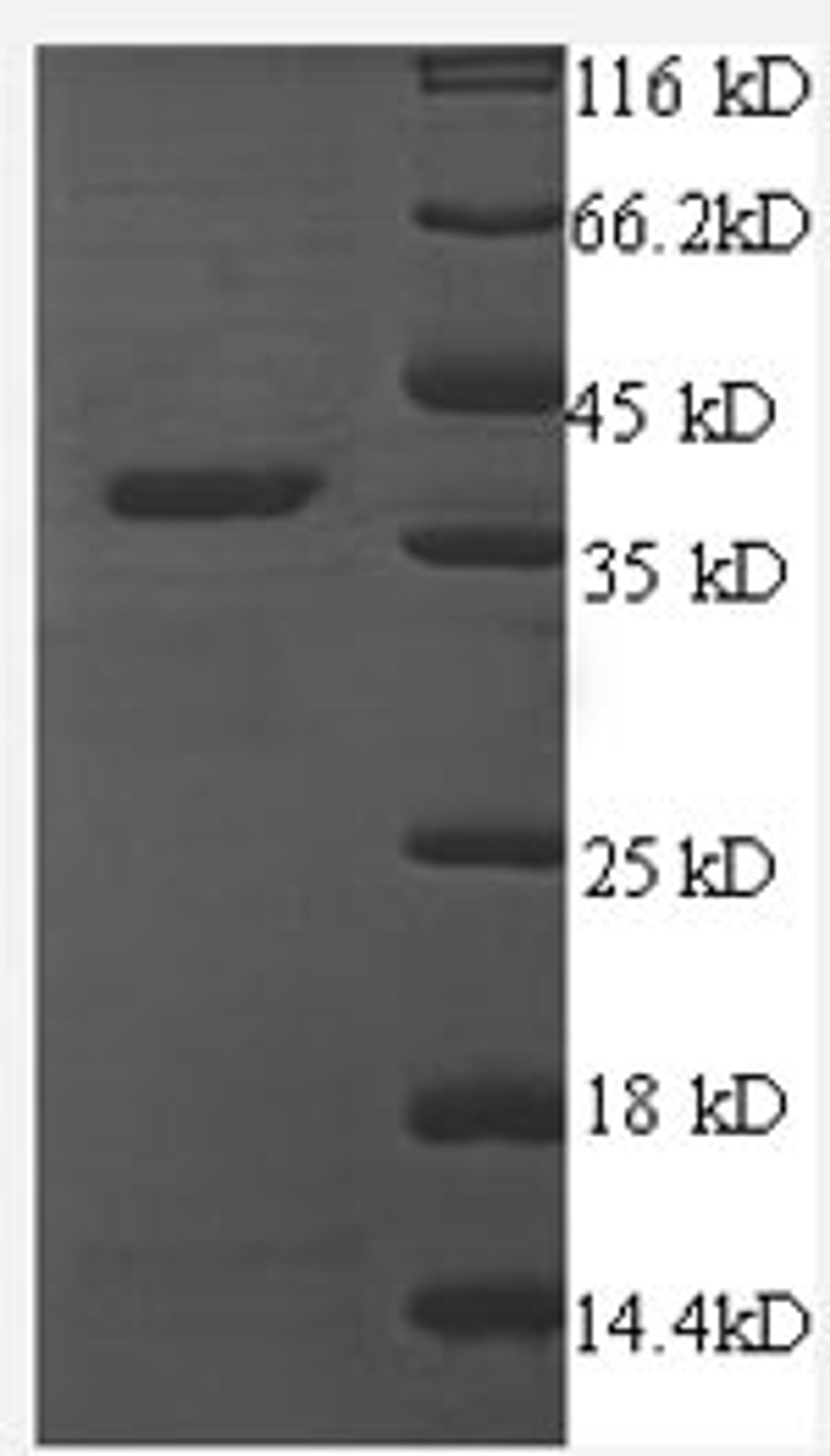 (Tris-Glycine gel) Discontinuous SDS-PAGE (reduced) with 5% enrichment gel and 15% separation gel.