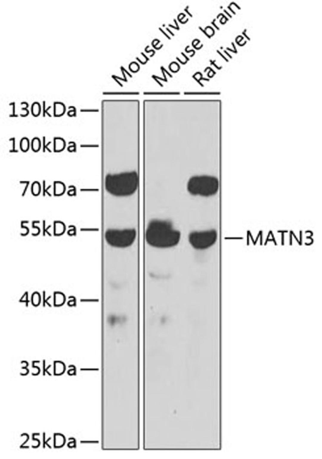 Western blot - MATN3 antibody (A7700)