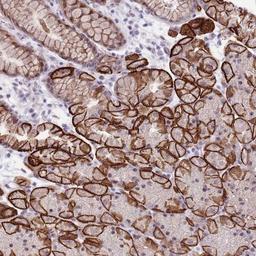 Immunohistochemistry-Paraffin: KRT74 Antibody [NBP2-14645] - Staining of human stomach, lower shows strong membranous positivity in glandular cells.