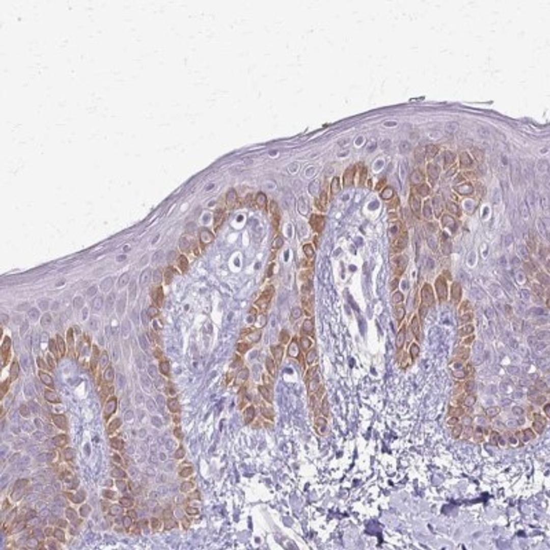 Immunohistochemistry: SLC35E2 Antibody [NBP2-31865] - Immunohistochemical staining of human skin shows moderate cytoplasmic positivity in keratinocytes.