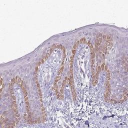 Immunohistochemistry: SLC35E2 Antibody [NBP2-31865] - Immunohistochemical staining of human skin shows moderate cytoplasmic positivity in keratinocytes.