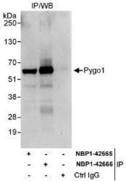 Immunoprecipitation: PYGO1 Antibody [NBP1-42665] - Whole cell lysate (1 mg for IP, 20% of IP loaded) from HeLa cells.   Affinity purified rabbit anti-Pygo1 antibody used for IP at 3 mcg/mg lysate.  Pygo1 was also immunoprecipitated by rabbit anti-Pygo1 antibody NBP1-42666, which recognizes a downstream epitope.