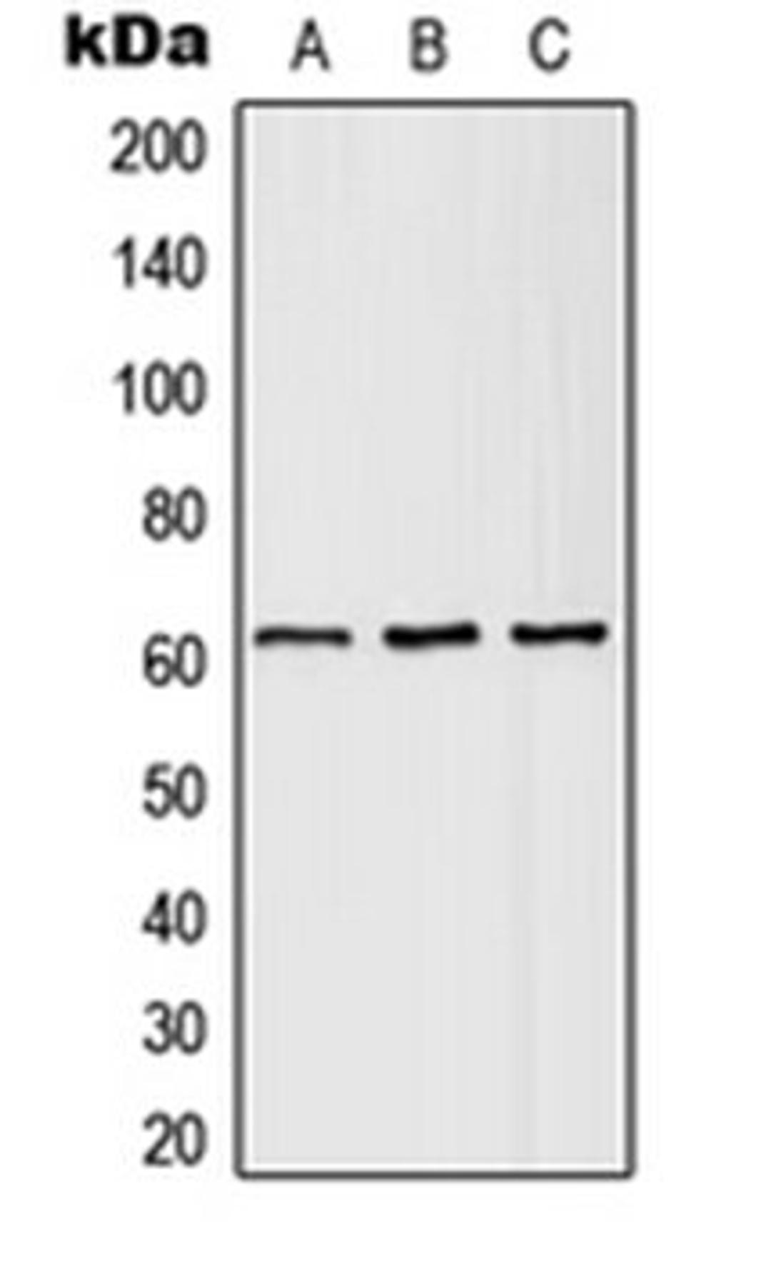 Western blot analysis of HEK293T (Lane 1), SP2/0 (Lane 2), H9C2 (Lane 3) whole cell lysates using SLC43A1 antibody