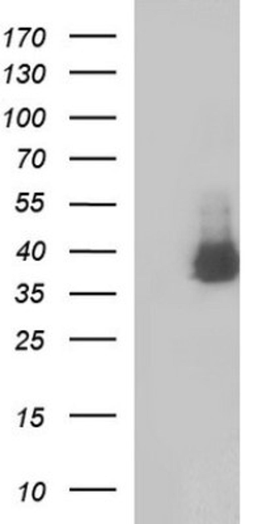 Western Blot: SHBG Antibody (1H10) [NBP2-45825] - Analysis of HEK293T cells were transfected with the pCMV6-ENTRY control (Left lane) or pCMV6-ENTRY SHBG.