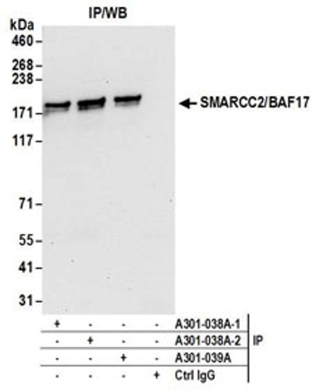 Detection of human SMARCC2/BAF170 by western blot of immunoprecipitates.