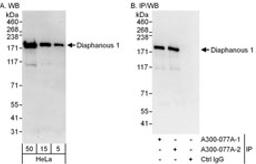 Detection of human Diaphanous 1 by western blot and immunoprecipitation.