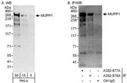 Detection of human MUPP1 by western blot and immunoprecipitation.