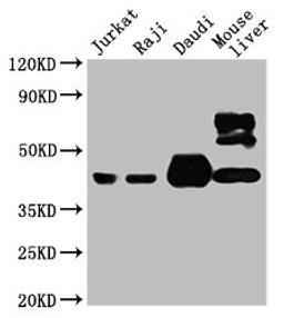 Western Blot. Positive WB detected in: Jurkat whole cell lysate, Raji whole cell lysate, Daudi whole cell lysate, Mouse liver tissue . All lanes: CD48 antibody at 1:4000. Secondary. Goat polyclonal to mouse IgG at 1/50000 dilution. Predicted band size: 28, 20KDa. Observed band size: 43 KDa. Exposure time:5min
