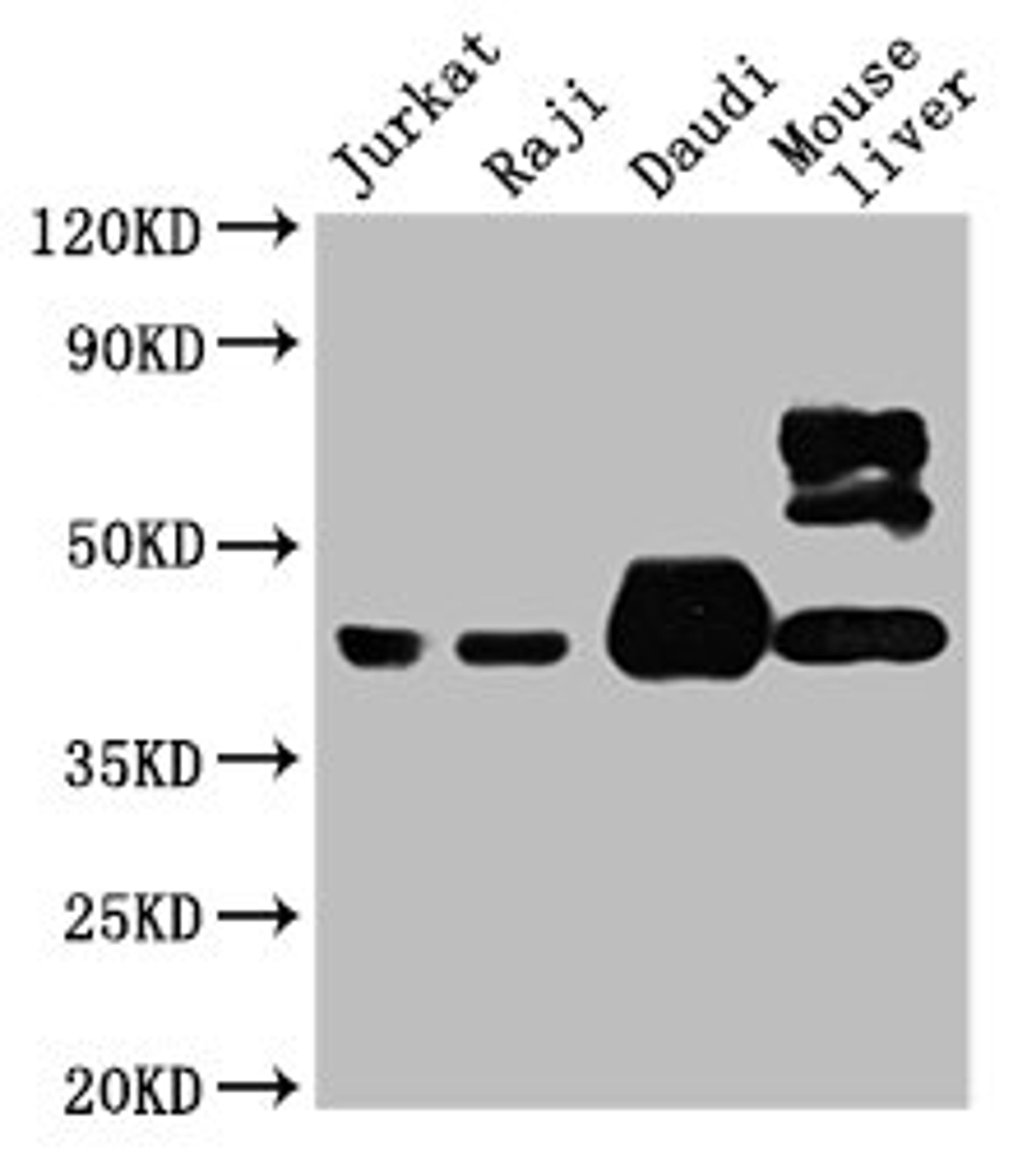 Western Blot. Positive WB detected in: Jurkat whole cell lysate, Raji whole cell lysate, Daudi whole cell lysate, Mouse liver tissue . All lanes: CD48 antibody at 1:4000. Secondary. Goat polyclonal to mouse IgG at 1/50000 dilution. Predicted band size: 28, 20KDa. Observed band size: 43 KDa. Exposure time:5min