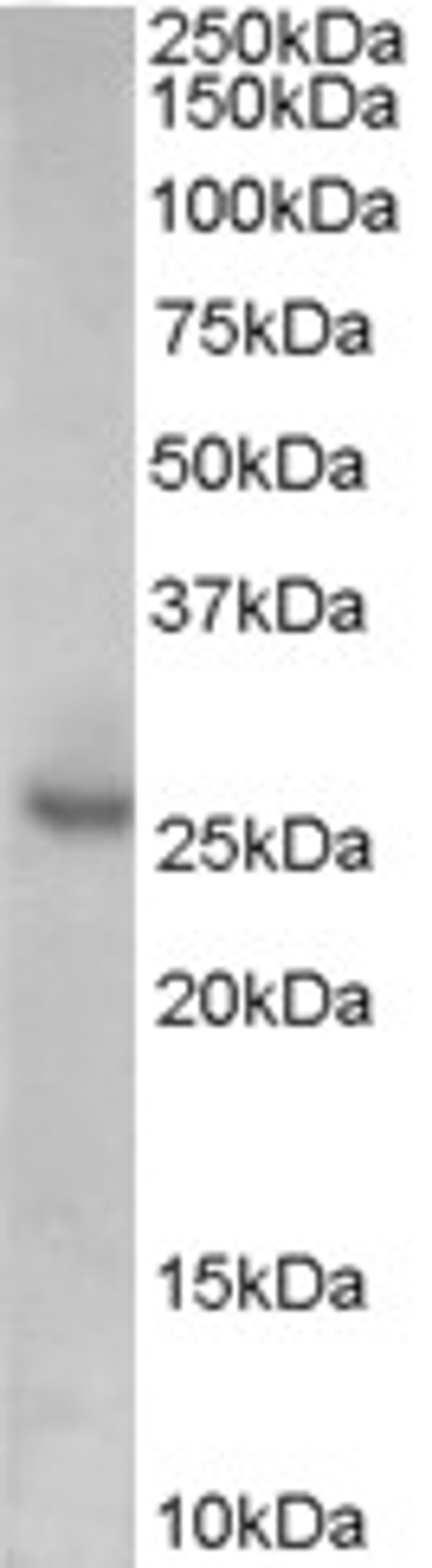 45-800 (0.1ug/ml) staining of Human Prostate lysate (35ug protein in RIPA buffer). Primary incubation was 1 hour. Detected by chemiluminescence.