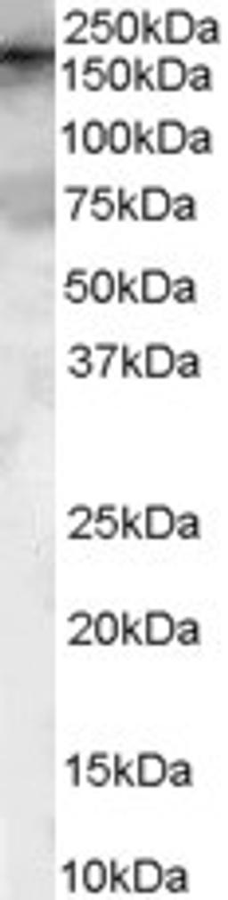 45-664 (0.1ug/ml) staining of HeLa Lysate (35ug protein in RIPA buffer). Primary incubation was 1 hour. Detected by chemiluminescence.