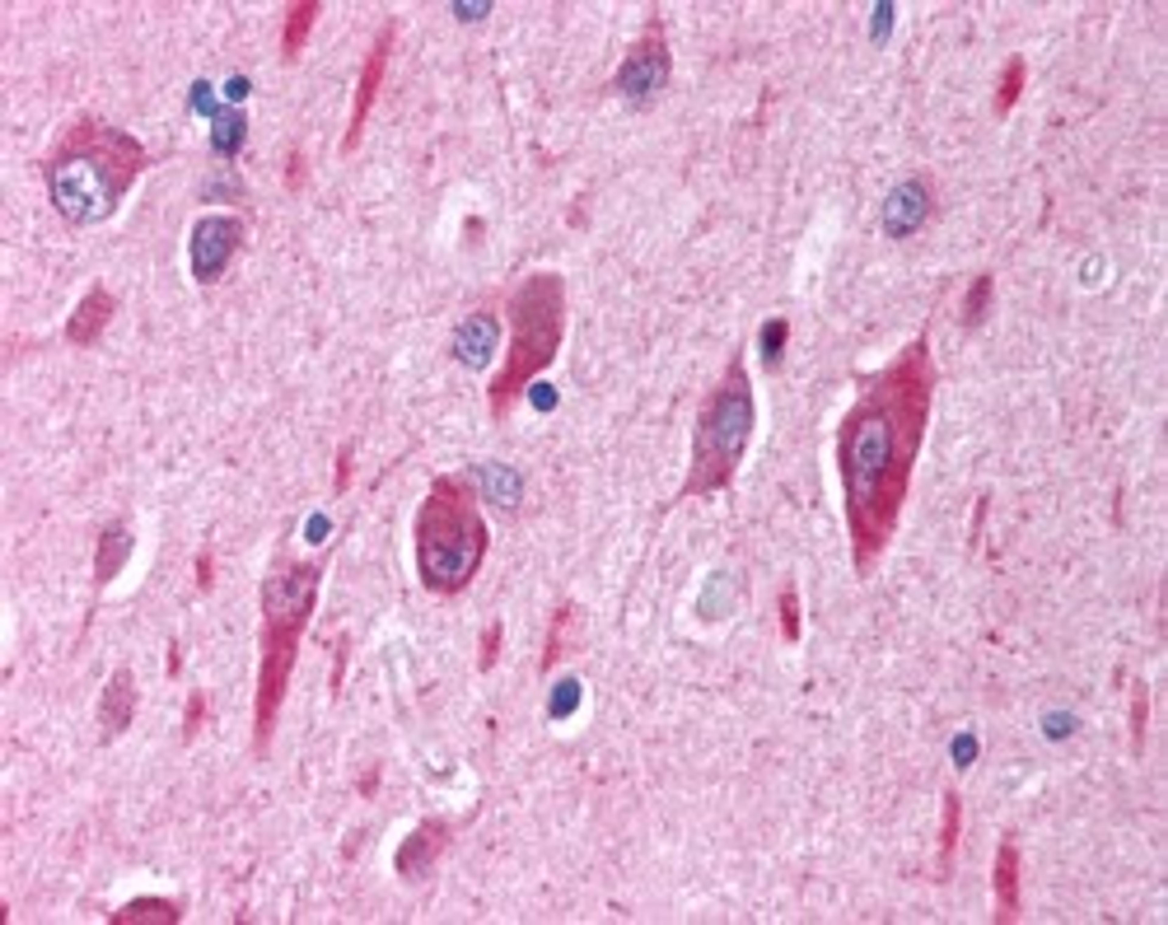 46-186 (2.5ug/ml) staining of paraffin embedded Human Brain (Cerebellar Cortex). Steamed antigen retrieval with citrate buffer pH 6, AP-staining.