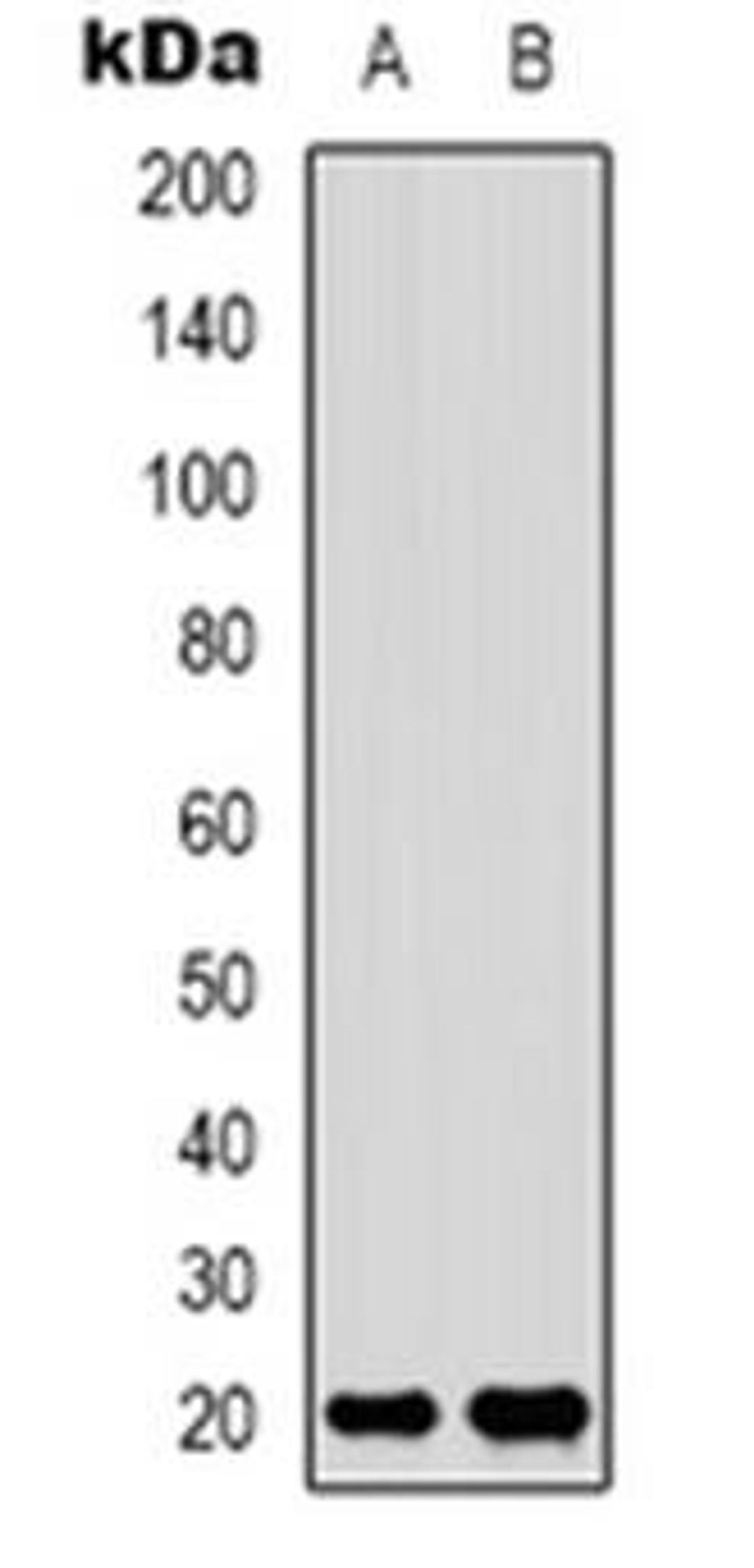 Western blot analysis of Adenylate Kinase 6 expression in Jurkat (Lane 1), HepG2 (Lane 2) whole cell lysates using AK6 antibody