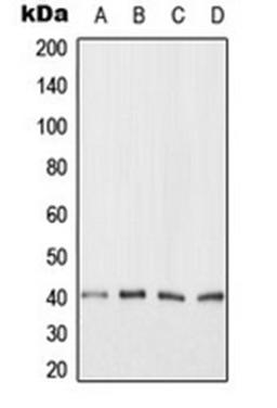 Western blot analysis of HeLa (Lane 1), Jurkat (Lane 2), NIH3T3 (Lane 3), H9C2 (Lane 4) whole cell lysates using ANKRD1 antibody