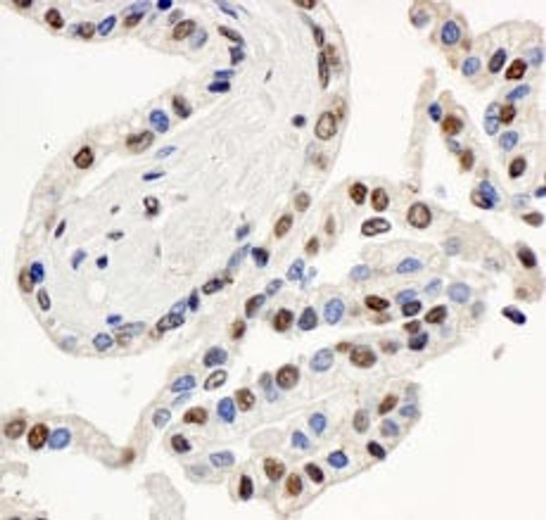 Detection of human BAF57/SMARCE1 by immunohistochemistry.