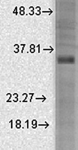 Western blot analysis of rat brain membrane lysates using BK Beta 3a antibody