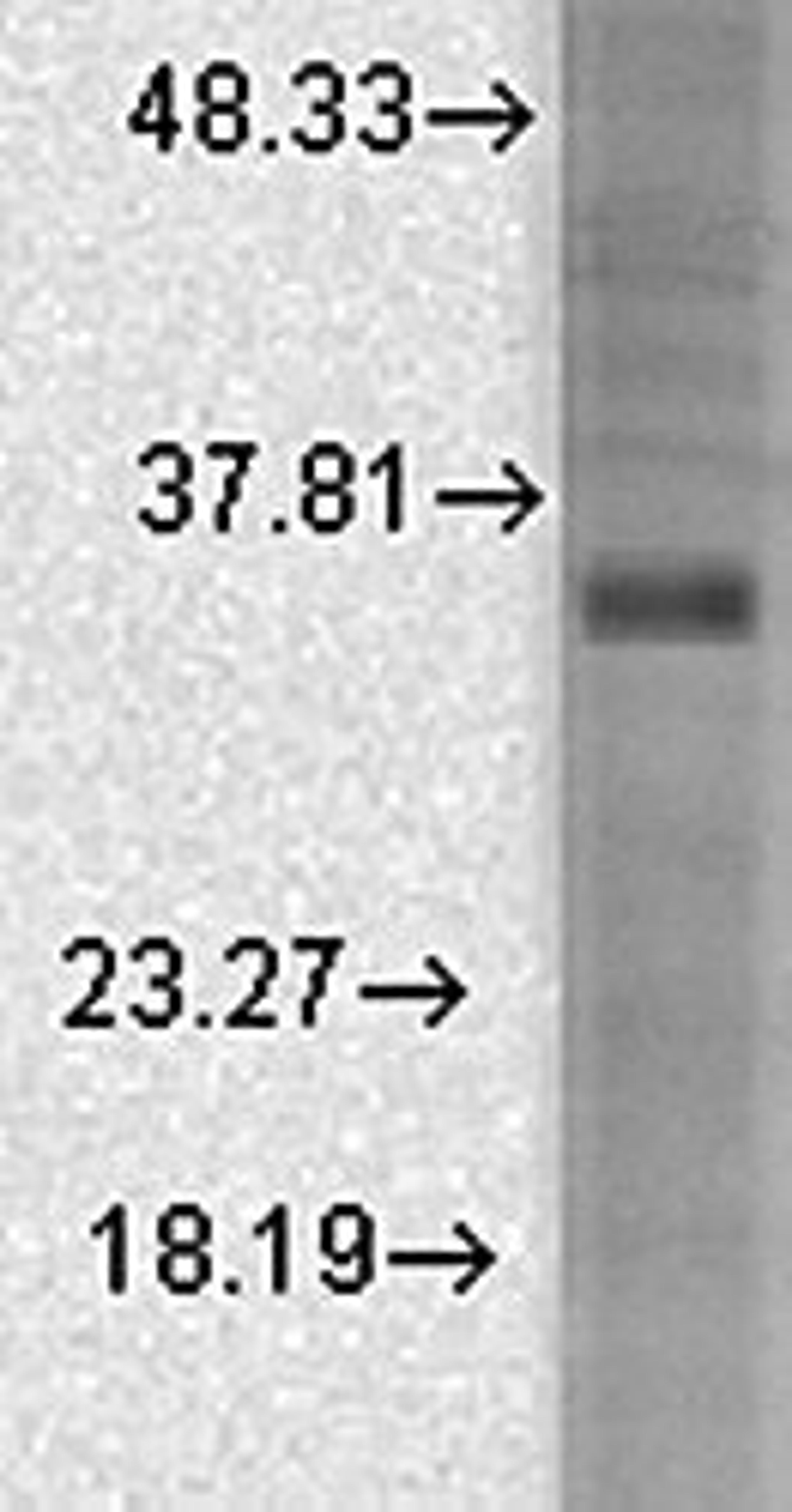 Western blot analysis of rat brain membrane lysates using BK Beta 3a antibody