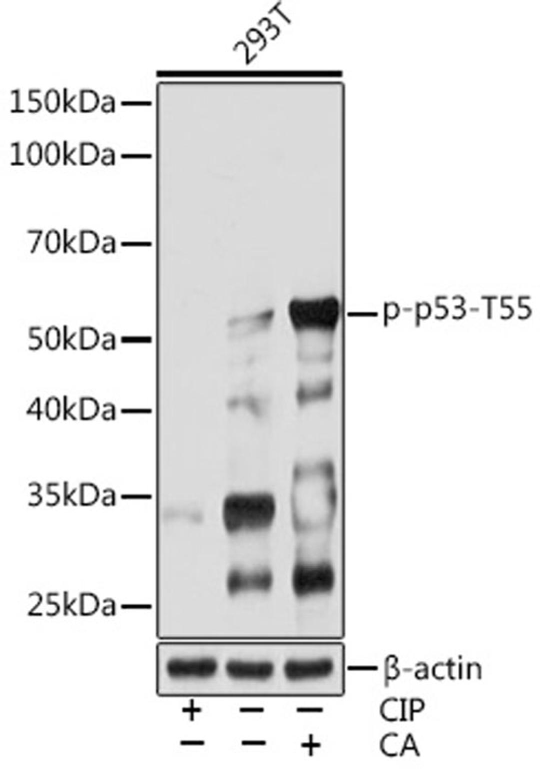 Western blot - Phospho-p53-T55 Rabbit mAb (AP0986)