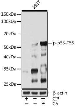 Western blot - Phospho-p53-T55 Rabbit mAb (AP0986)