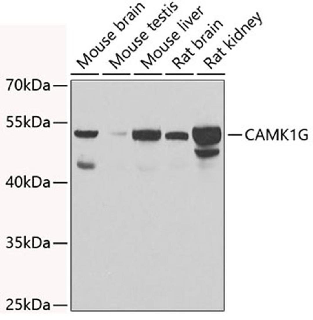 Western blot - CAMK1G antibody (A7379)