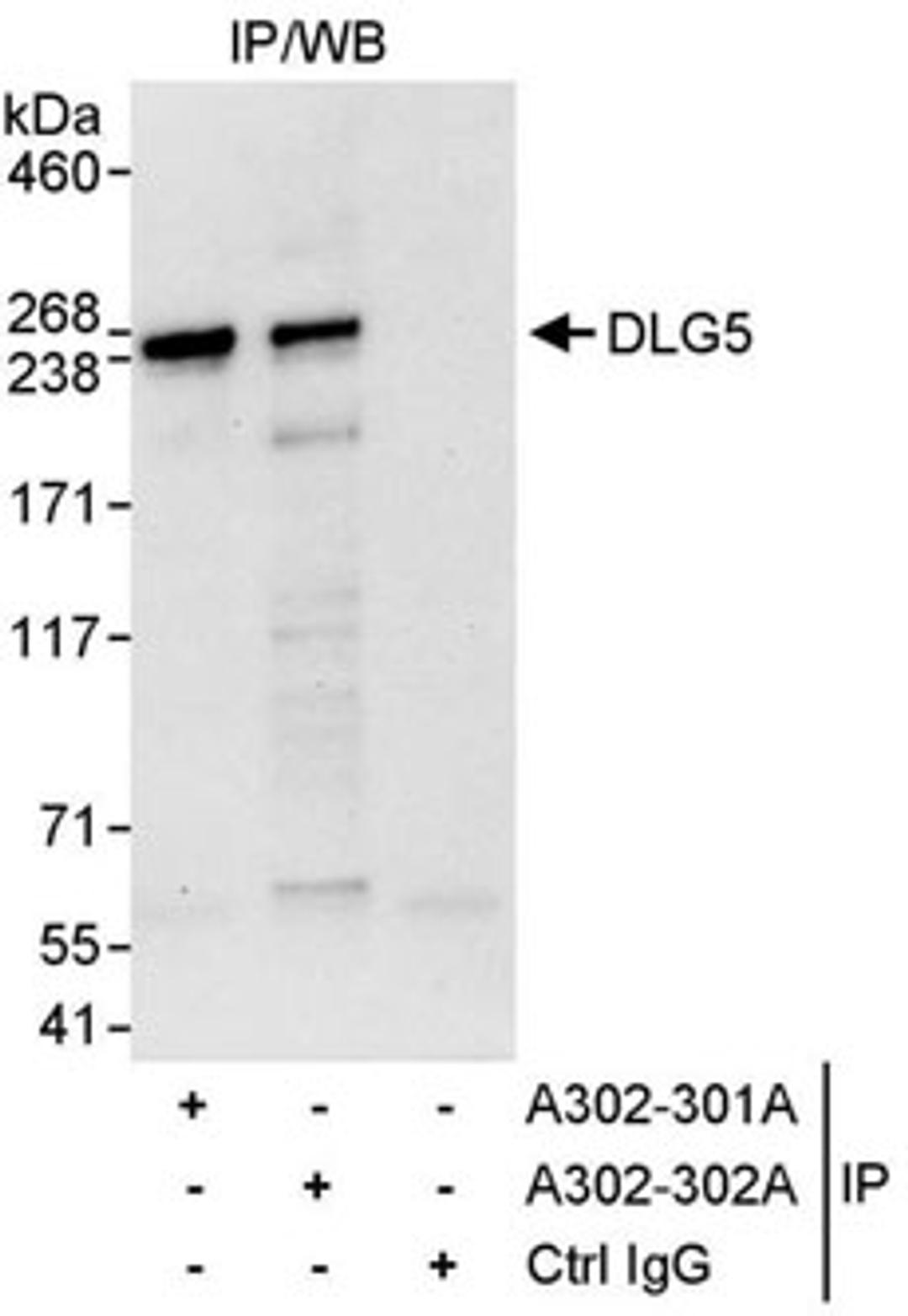 Detection of human DLG5 by western blot of immunoprecipitates.