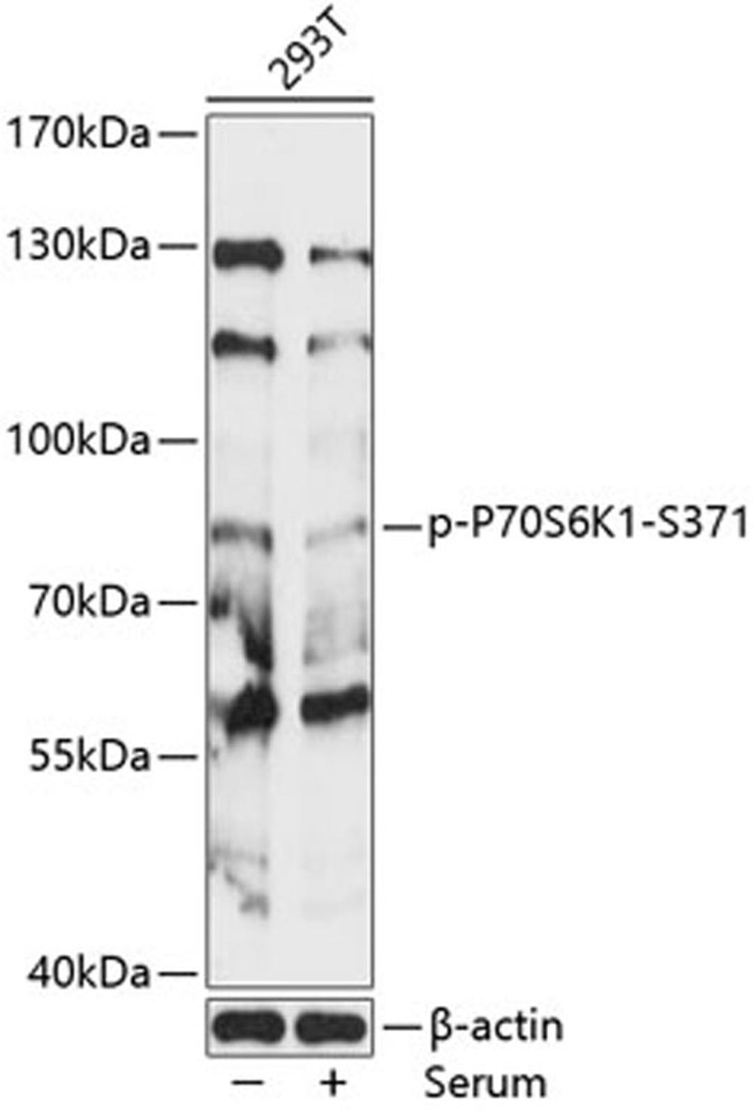 Western blot - Phospho-P70S6K1-S371 antibody (AP0482)