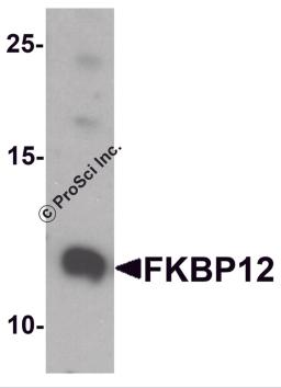 Western blot analysis of FKBP12 in A431 cell lysate with FKBP12 antibody at 1 &#956;g/ml.