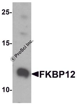 Western blot analysis of FKBP12 in A431 cell lysate with FKBP12 antibody at 1 μg/ml.