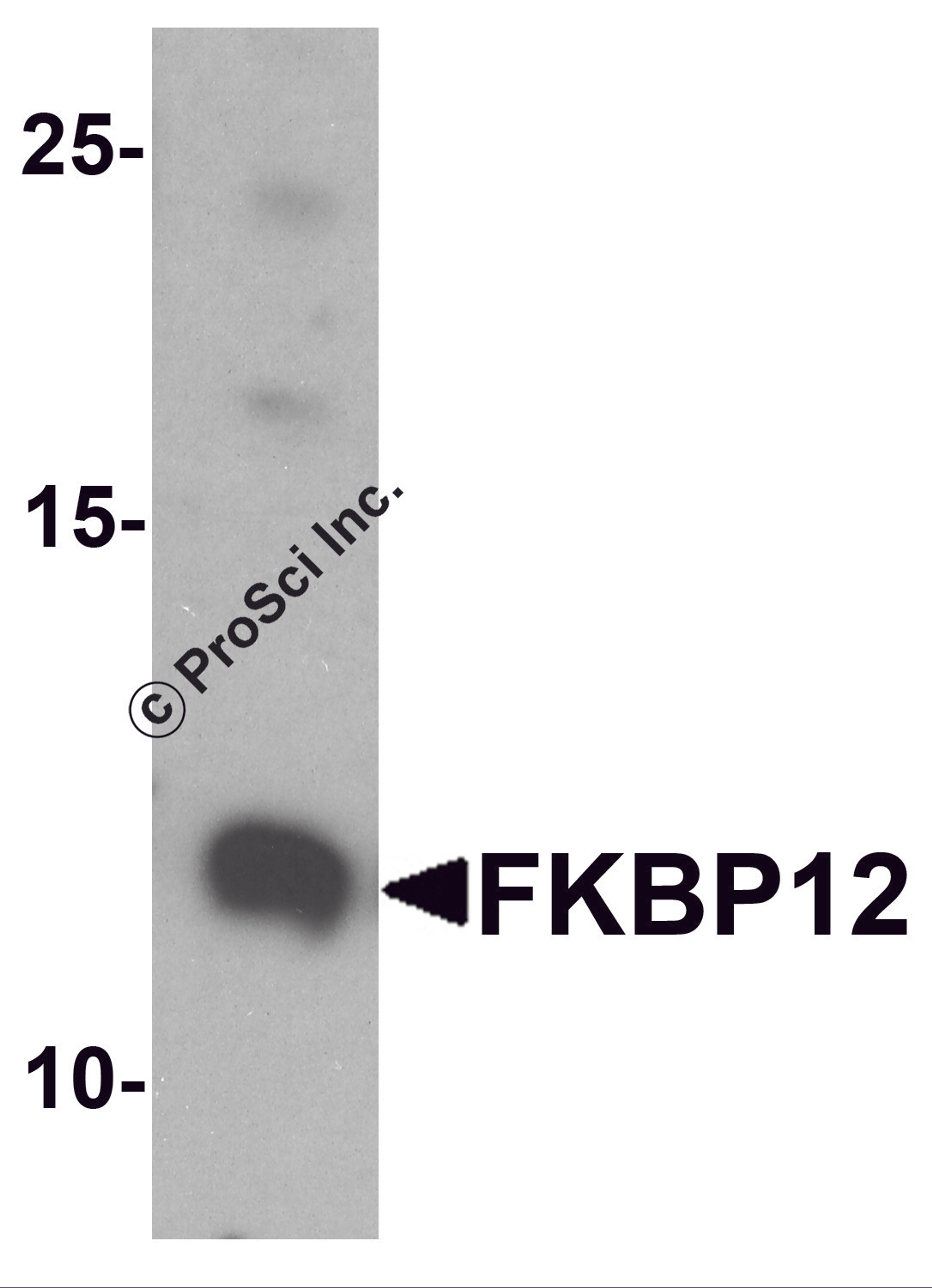 Western blot analysis of FKBP12 in A431 cell lysate with FKBP12 antibody at 1 μg/ml.