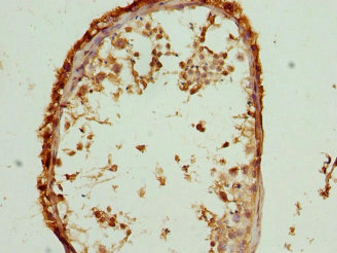 Immunohistochemistry of paraffin-embedded human testis tissue using CSB-PA02625A0Rb at dilution of 1:100