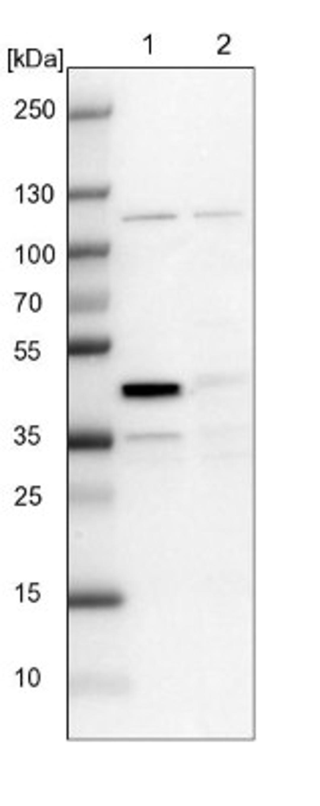 Western Blot: CCDC94 Antibody [NBP1-91766] - Lane 1: NIH-3T3 cell lysate (Mouse embryonic fibroblast cells)<br/>Lane 2: NBT-II cell lysate (Rat Wistar bladder tumour cells)