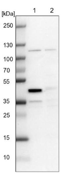 Western Blot: CCDC94 Antibody [NBP1-91766] - Lane 1: NIH-3T3 cell lysate (Mouse embryonic fibroblast cells)<br/>Lane 2: NBT-II cell lysate (Rat Wistar bladder tumour cells)