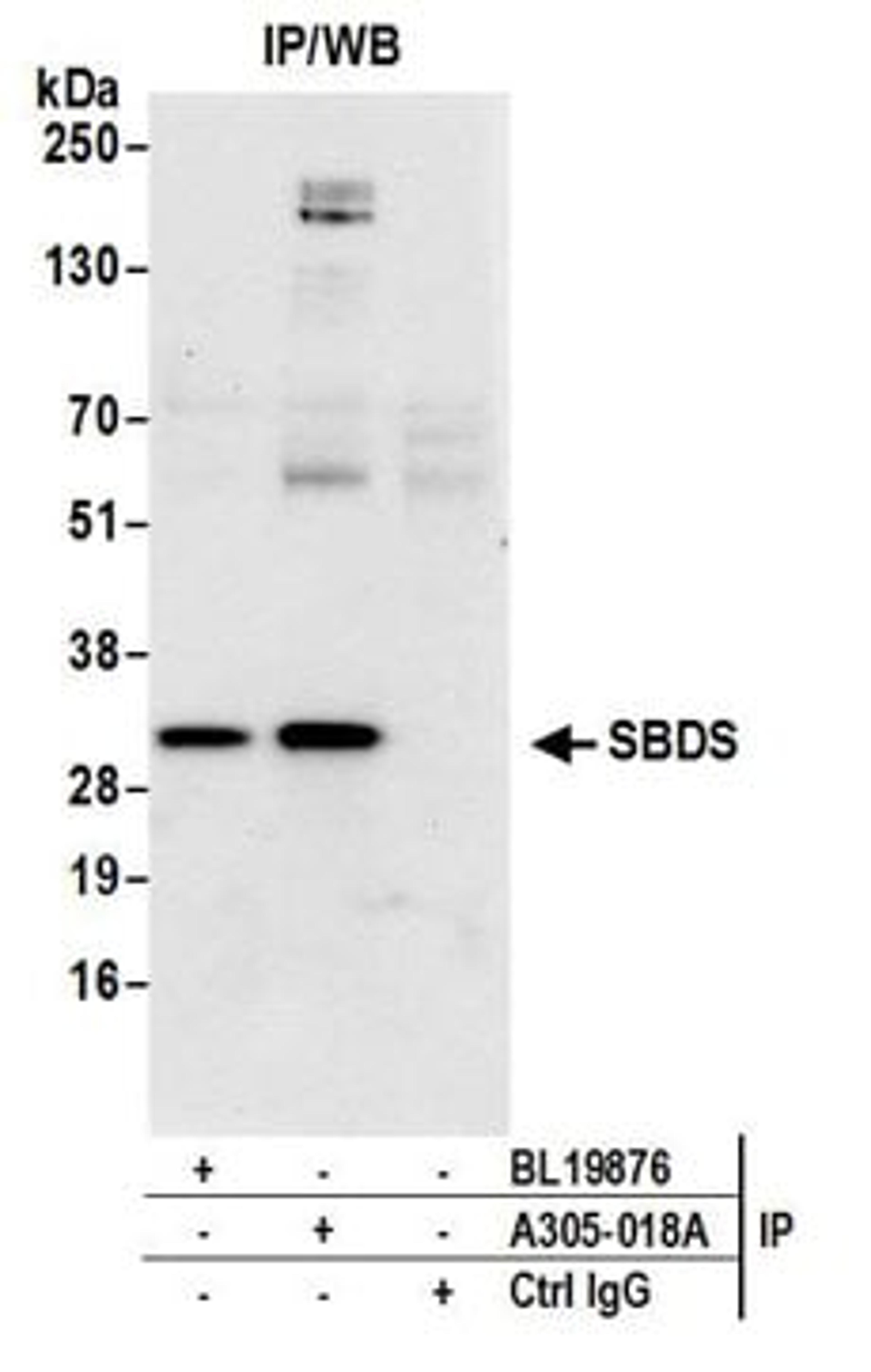 Detection of human SBDS by western blot of immunoprecipitates.