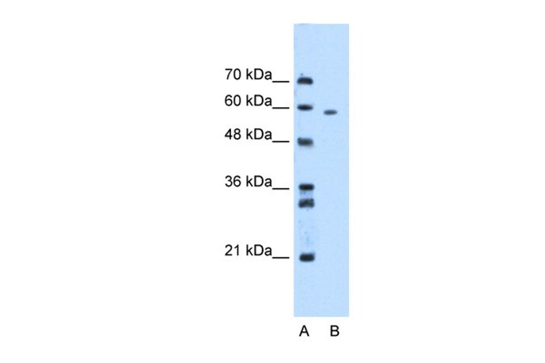 Antibody used in WB on Human HepG2 at 2.5 ug/ml.