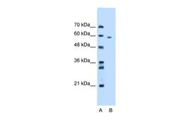 Antibody used in WB on Human HepG2 at 2.5 ug/ml.