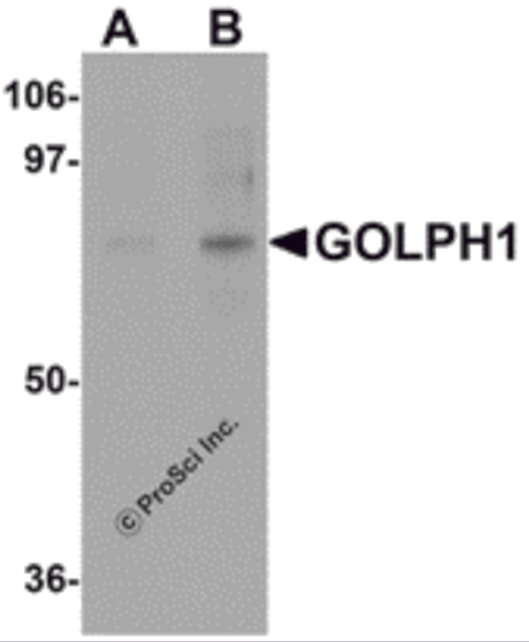 Western blot analysis of GOLPH1 in K562 cell lysate with GOLPH1 antibody at (A) 1 and (B) 2 μg/mL.