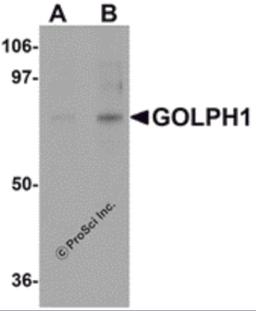 Western blot analysis of GOLPH1 in K562 cell lysate with GOLPH1 antibody at (A) 1 and (B) 2 μg/mL.