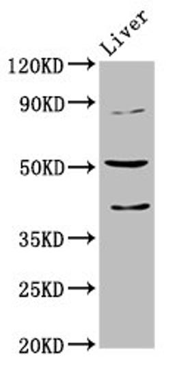 Western Blot. Positive WB detected in: Mouse liver tissue. All lanes: CHRNB3 antibody at 5.1ug/ml. Secondary. Goat polyclonal to rabbit IgG at 1/50000 dilution. Predicted band size: 53 kDa. Observed band size: 53 kDa.
