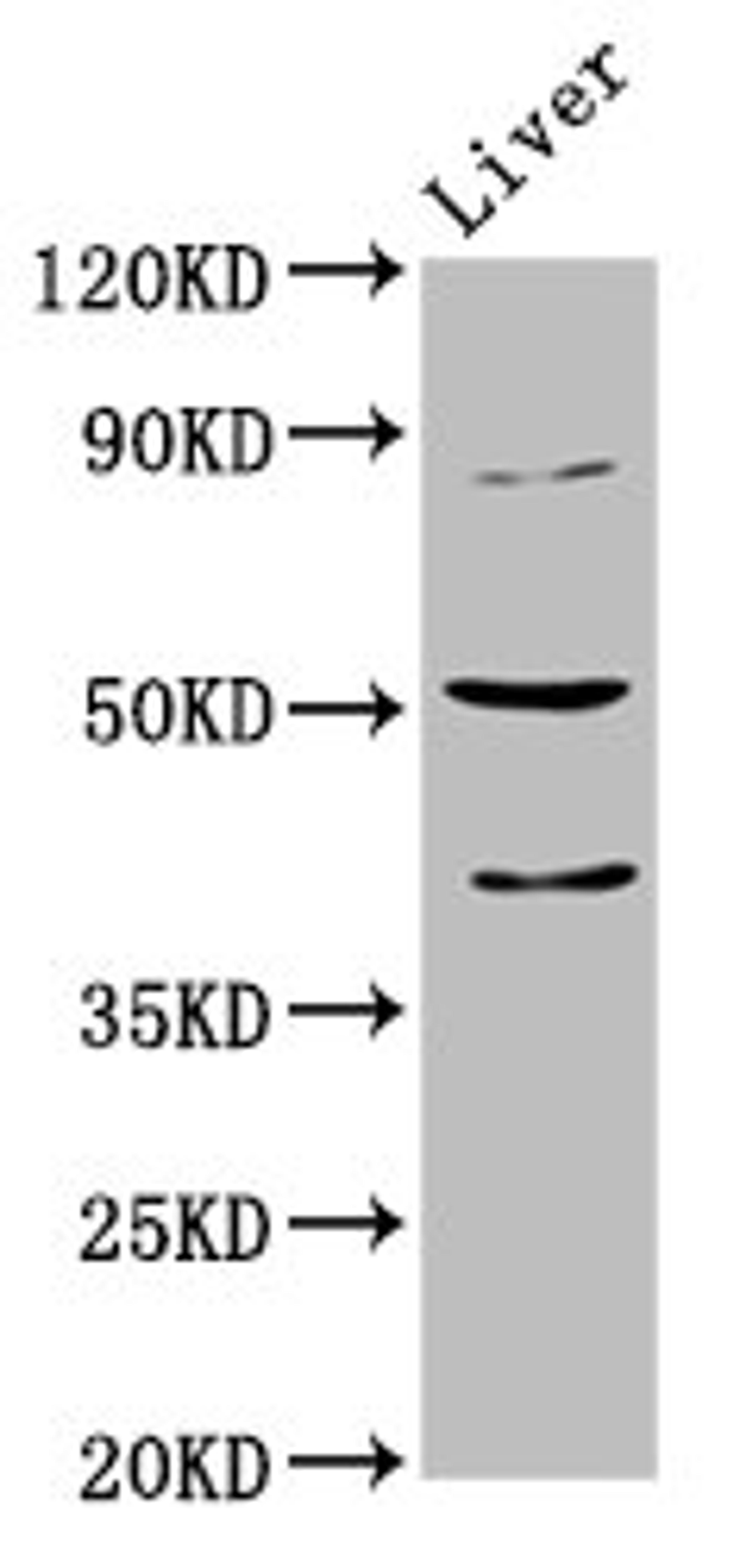 Western Blot. Positive WB detected in: Mouse liver tissue. All lanes: CHRNB3 antibody at 5.1ug/ml. Secondary. Goat polyclonal to rabbit IgG at 1/50000 dilution. Predicted band size: 53 kDa. Observed band size: 53 kDa.