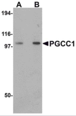 Western blot analysis of PGCC1 in rat thymus tissue lysate with PGCC1 antibody at (A) 0.5 and (B) 1 &#956;g/mL.