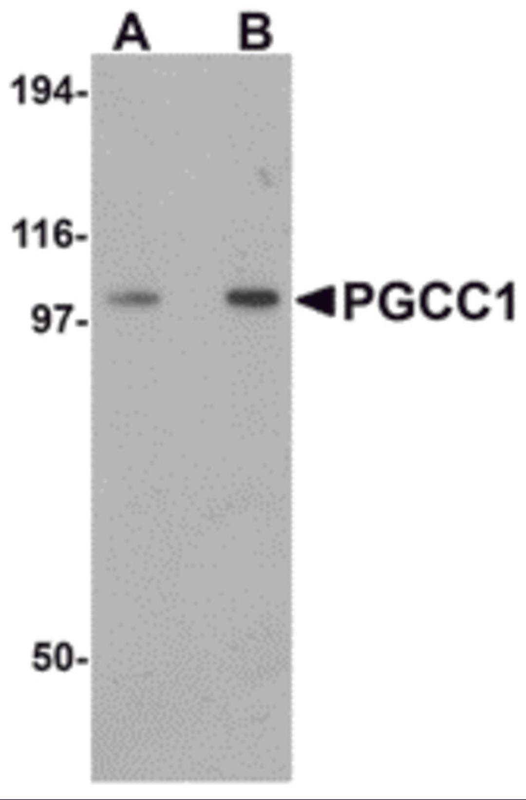 Western blot analysis of PGCC1 in rat thymus tissue lysate with PGCC1 antibody at (A) 0.5 and (B) 1 μg/mL.
