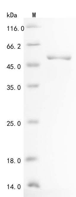 (Tris-Glycine gel) Discontinuous SDS-PAGE (reduced) with 5% enrichment gel and 15% separation gel.