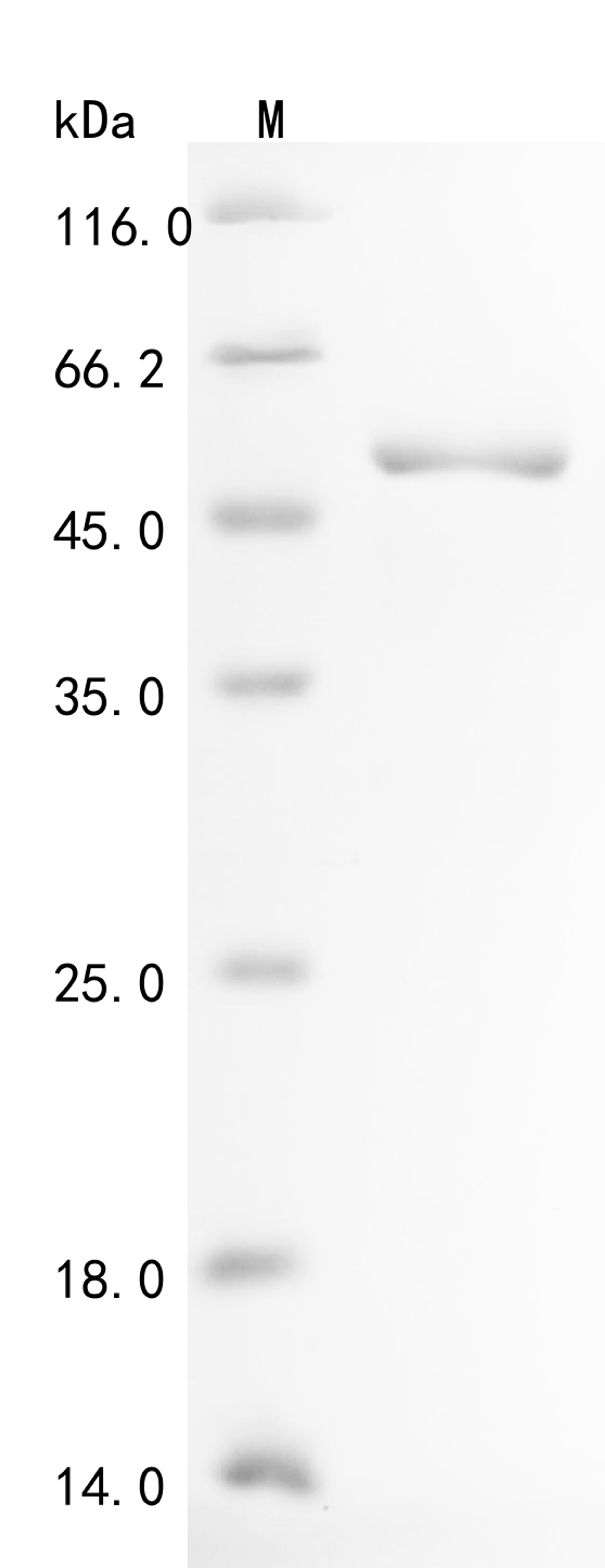 (Tris-Glycine gel) Discontinuous SDS-PAGE (reduced) with 5% enrichment gel and 15% separation gel.